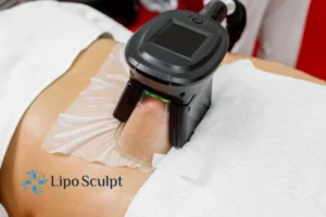Are The Results From Aqualyx Permanent? 4 Compare Aqualyx Springs Mire to other fat reduction treatments.