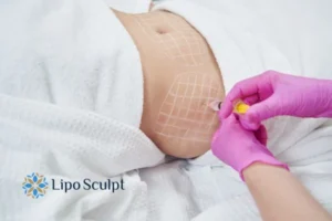 Are The Results From Aqualyx Permanent? 1 Do you want to know how long Aqualyx Springs Mire results last?